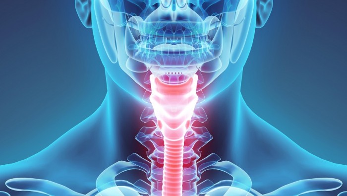 larynx artificiel